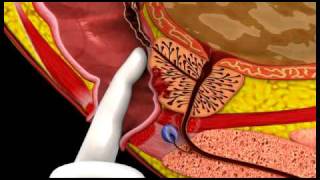 Introduction to Cancer Biology Part 2 Loss of Apoptosis [upl. by Yadahs]