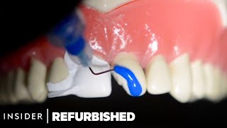 How Damaged Teeth Are Professionally Restored  Refurbished  Insider [upl. by Franky]