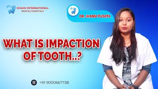 What Is Tooth Impaction  Impacted Tooth Definition amp Causes Ocean International Dental Hospital [upl. by Ynez91]