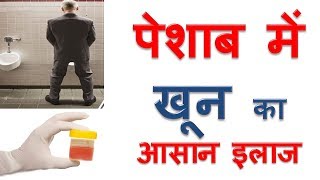 पेशाब में खून आने का इलाज Peshab Mein Khoon Ka ilaj Blood in Urine Home Remedies in Hindi [upl. by Tertias837]