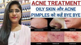 Acne Pimples Treatment।।Best Homeopathic Soap for oily skin।। [upl. by Halland]