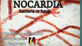 Nocardia ।। IntroductionScientific Classification Pathogenesis Laboratory Diagnosis of Nocardia [upl. by Nwad335]