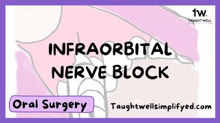 INFRAORBITAL NERVE BLOCK TECHNIQUE  Tips for finding the infraorbital foramen [upl. by Ilram]