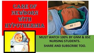 Care of newborn with hypothermia [upl. by Franky]