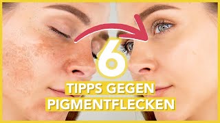 Pigmentflecken entfernen – die 6 BESTEN TIPPS gegen Hyperpigmentierung [upl. by Nnad]