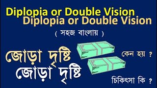 Diplopia or Double vision causes and treatment diplopia doublevision diplopiacausesandtreatment [upl. by Noirred]