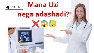 MANA NIMA UCHUN UZI HOMILA JINSINI XATO AYTADI😨😱😱😱❌❌❌❌❌❌❌❌ BUNI BILISHINGIZ SHART🔥💯🆘🆘🆘🆘✅✅✅ [upl. by Drogin]