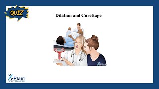 Dilation and Curettage  Quiz [upl. by Riem]