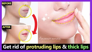 How to get rid of Protruding Mouth and Lips naturally  Make Thick lips to Thin lips with exercises [upl. by Felt]