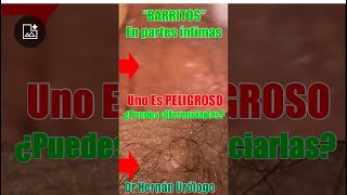 “BARRITOS” en partes íntimas  ¿cuáles son PELIGROSOS barrito espinilla acne molusco its ets [upl. by Hotchkiss]