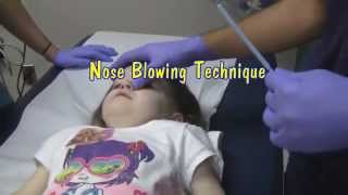 Nasal Foreign Body Removal Techniques [upl. by Bloxberg]