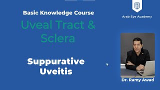 Lecture 9 Uveal tract and sclera Part 3 Suppurative uveitis special types of uveitis [upl. by Eiramesor]