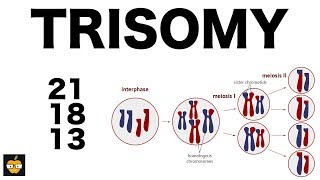 Trisomy 21 18 and 13 amp Nondisjunction Genetics [upl. by Danyette650]