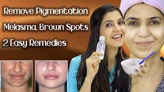 Remove Pigmentation Melasma Freckles Brown Spots  Results In One Week  Ghazal Siddique [upl. by Meldoh]