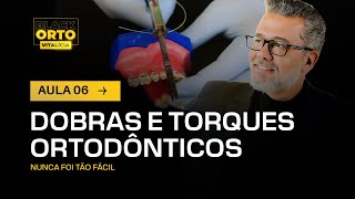 Aula 69  Dobras e torques ortodônticos [upl. by Amado564]