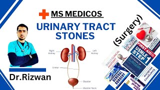 Urinary Tract Stones SurgeryMS MedicosDr RizwanUrdu Hindi Easy Explanations [upl. by Roy]