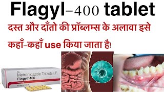 Flagyl 400 tablet uses in hindimetronidazole tablet uses in hindihow to use amp work flagyl 400 tab [upl. by Palladin]