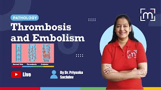 Thrombosis and Embolism with Dr Priyanka Sachdev [upl. by Mathilde]