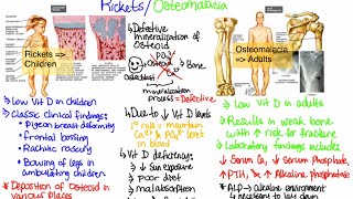 What is RicketsOsteomalacia [upl. by Daegal]