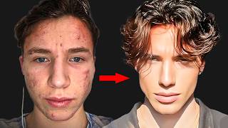 Ugly Guy Glows Up And Becomes Calvin Klein Model full method explained [upl. by Sleinad]