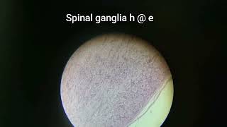 Spinal ganglia HampE [upl. by Sirtemed180]