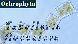 Tabellaria flocculosa Bacillariophyceae or Diatoms [upl. by Darra]