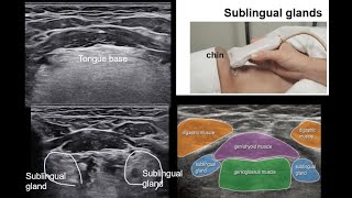 ENGNeck anatomy2center [upl. by Anegue286]