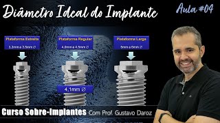 Como Selecionar o DIÂMETRO ideal dos Implantes  Curso SOBREIMPLANTES  Aula 04 [upl. by Aimo]