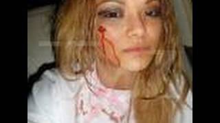 Tila Tequila Attacked at A insane clown posse Concert at The Gathering Of The Juggalos News [upl. by Refiffej]