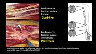 Neuromusculoskeletal Ultrasound for Peripheral Nerve Entrapment and Nerve Injuries [upl. by Nipha]