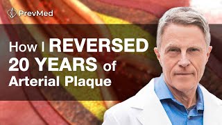 How I Reversed 20 years of Arterial Plaque [upl. by Miyasawa]