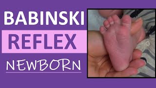 Babinski Reflex Assessment in Newborn Infant  Pediatric Nursing Clinical Skills [upl. by Meador171]