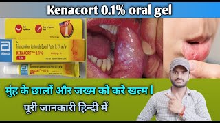 Kenacort 01 oral gel use dose benefits and Side effects full review in hindi [upl. by Marjorie]