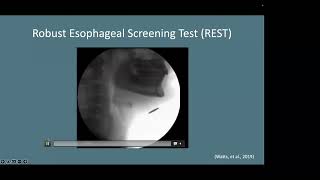 The ‘Anatomy’ of Esophageal Dysphagia Current State and Future Direction [upl. by Nanda825]