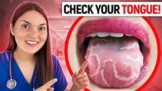 What your TONGUE says about your HEALTH Doctor Explains [upl. by Las]