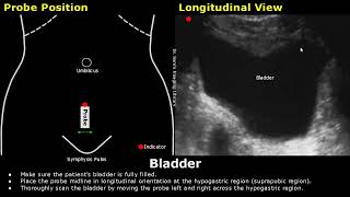 How to Scan The Bladder On Ultrasound  Probe Positioning  Transducer Placement  Abdominal USG [upl. by Adnael]