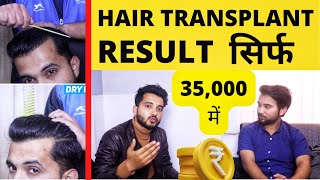 Life After Full Hair Transplant Result Of Saurabh Kukreti  Best Hairline Ever Created In History [upl. by Burrton]