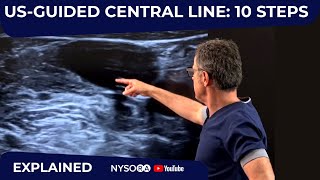 USGuided Central Line 10 Steps  Crash course with Dr Hadzic [upl. by Euqirne428]