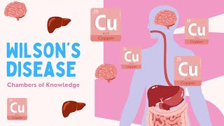 Wilson’s Disease From Diagnosis to Management – What You Need to Know [upl. by Crissy]