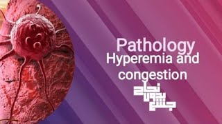 Hyperemia and congestionpathoL14 part 1 [upl. by Dawkins]