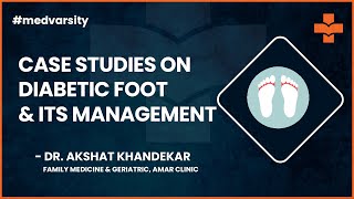 Medical Case Discussion on Diabetic foot and its Management  Assimilate by Medvarsity [upl. by Atena]