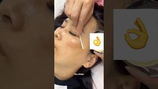 1Week Dark Spots amp Pigmentation Removal Challenge  Get Fair amp Spotless Skin beauty skin shorts [upl. by Nylaras880]