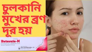 Batavate N Cream এর কাজ ব্যবহার বিস্তারিত medical motivation skincare usesside effect [upl. by Iah]