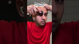 Day112 of Restoring Hairline [upl. by Oniliuqnart801]