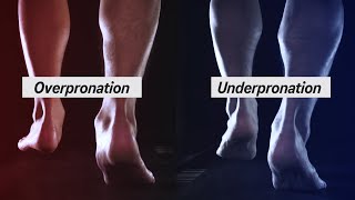 How to Determine your Pronation [upl. by Alleras35]