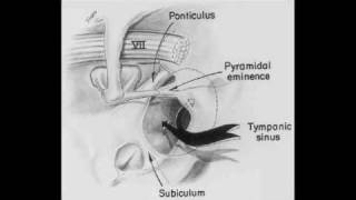 Middle Ear Anatomy Otoscopic approach [upl. by Euqinue]