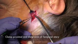 Temporal Artery Biopsy [upl. by Demaggio949]