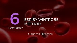 ESR by Wintrobe Method [upl. by Jeth357]