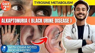 tyrosine metabolism biochemistry  alkaptonuria biochemistry  black urine disease biochemistry [upl. by Llerehs30]