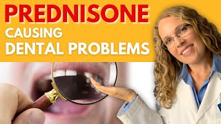 Prednisone Causing Dental Problems [upl. by Karlik]